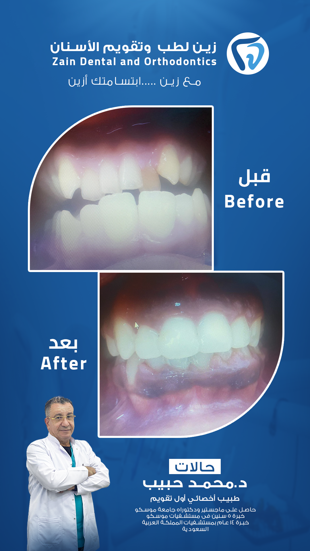 قبل وبعد د حبيب 3 - Copy